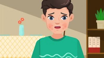 过敏性皮炎几天能好